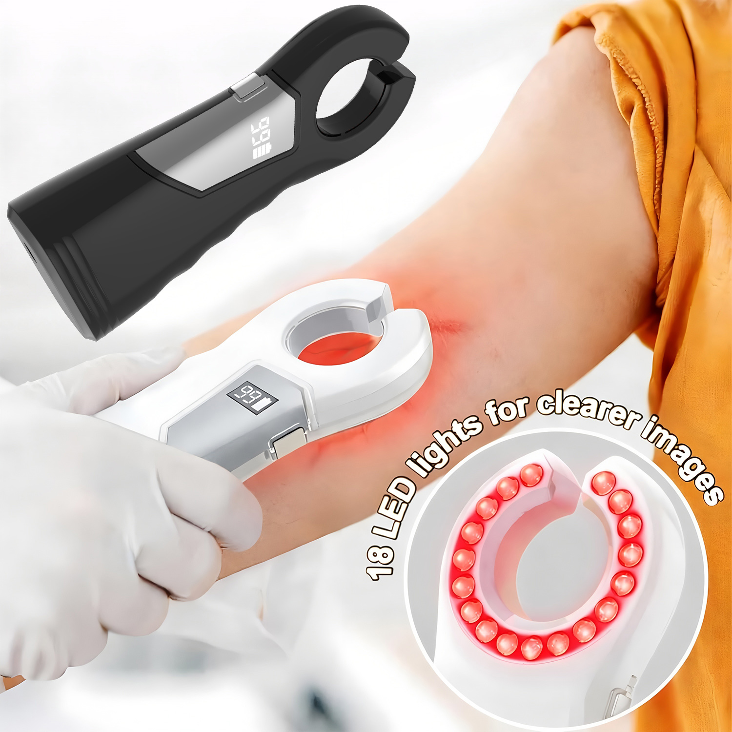 Medical Infrared Vein Locator  - Medical Lab Science incelemesi ve fiyatı
